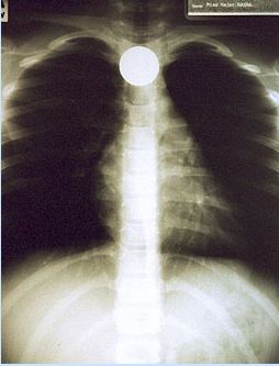 Hayrete düşüren röntgen filmleri