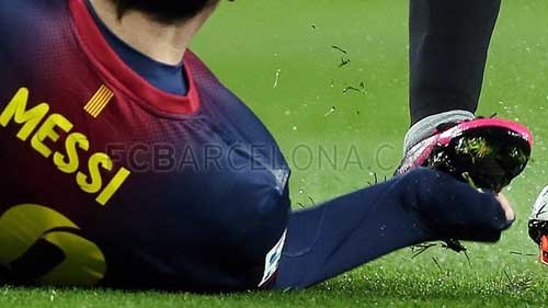 Lionel Messi kanlar içinde kaldı!