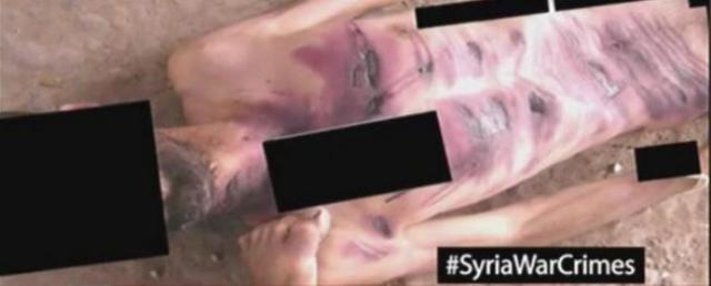 Suriye'deki bu görüntüler dünyayı ayağa kaldıracak