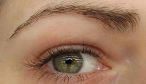 Göz damarlarında meydana gelen tıkanıklığın koronavirüs belirtisi olabileceği uyarısı