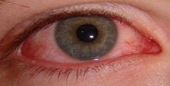 kirmizi-1204312-350x178.jpg