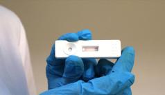 Dünya genelinde Kovid-19 vaka sayısı 79 milyonu geçti