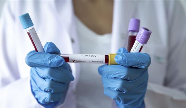 Çinde Koronavirüs salgınında ölenlerin sayısı 2 bin 120ye çıktı