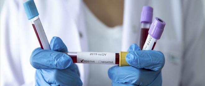 KKTCde ilk koronavirüs tespit edildi